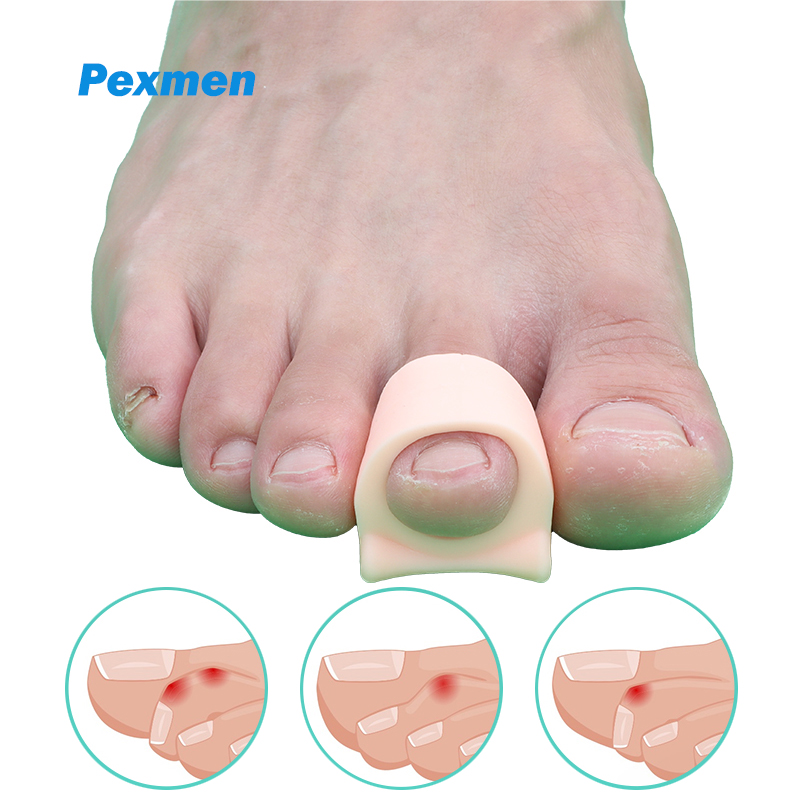 Power Tools Hammer - Pexmen 2/4Pcs Hammertoe Corrector Toe Splints